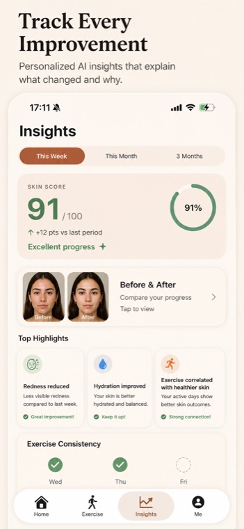 SkinLab Insights screen showing a 91/100 skin score, a before-and-after comparison, and top highlights explaining what improved